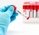 התפרצות חזרת במודיעין – האם יש סיבה לדאגה?-תמונה